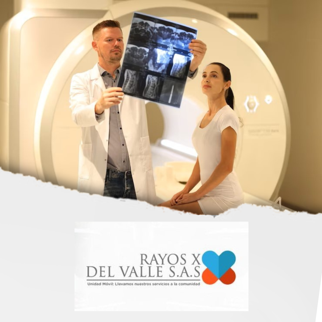 Rayos X Del Valle