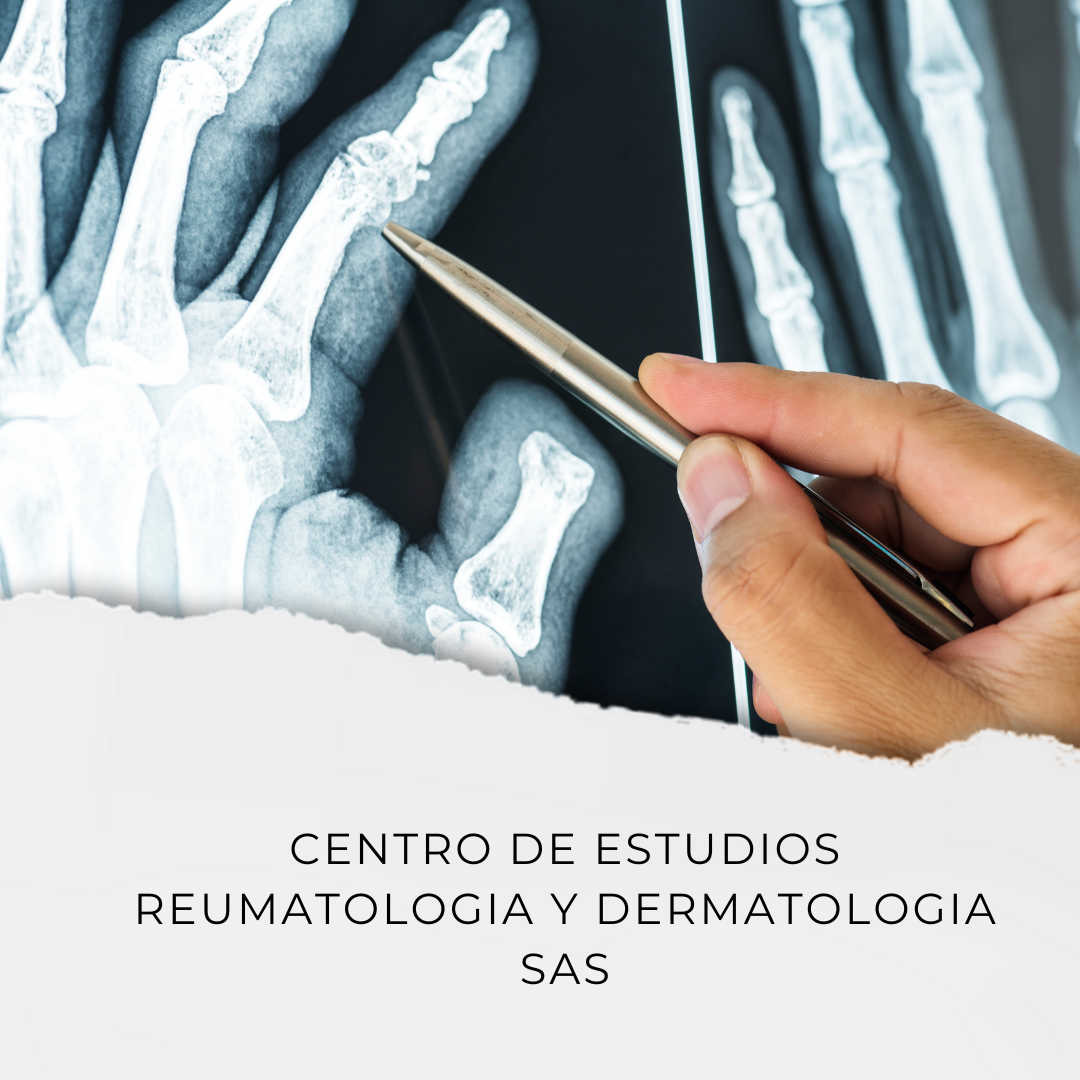 Centro De estudios Reumatología y Dermatología