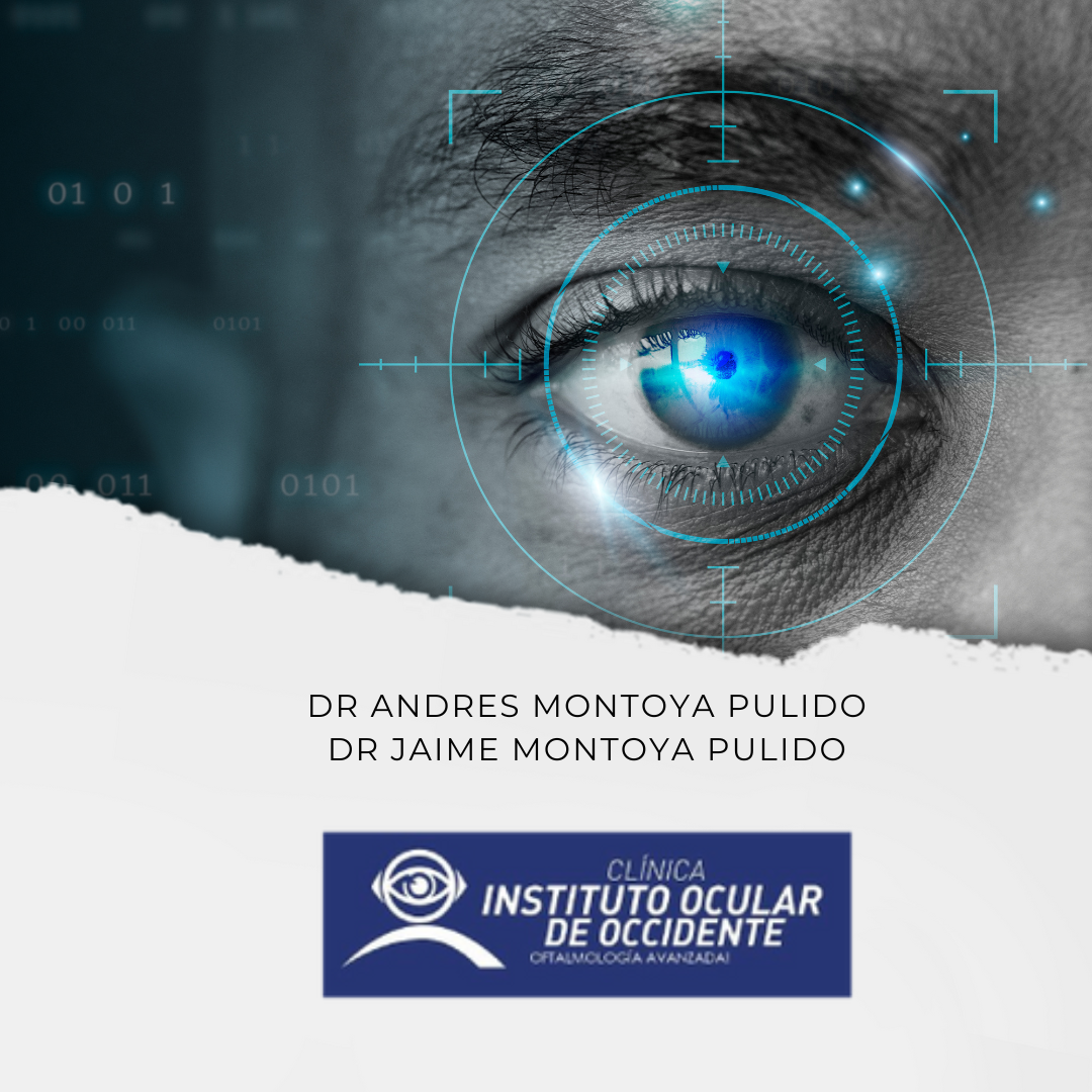 Instituto Ocular de Occidente -